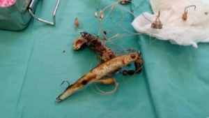 "Vanesa" ha tenido que ser intervenida en el quirófano por el equipo veterinario del Centro de Recuperación de Palma Aquarium